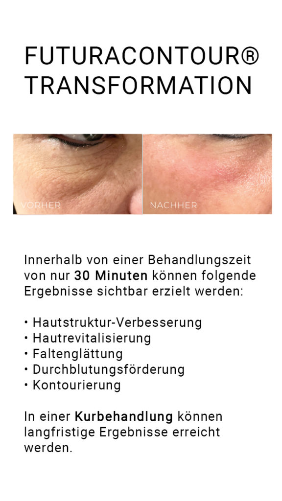 Futuracontour - sichtbare Ergebnisse schon nach 30 Minuten Behandlung